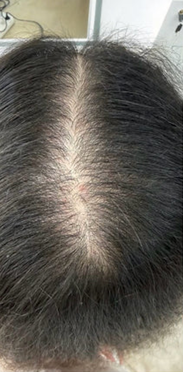 Cheveux avant la routine JASS